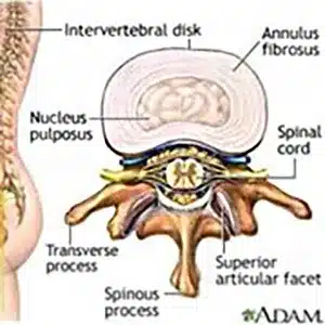 Chiropractic Traverse City MI Intervertebral Disc